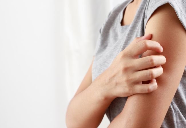 Women torso from the side scratchting her arm